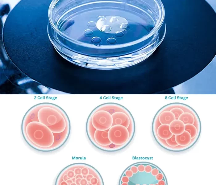 Best IVF Center in Mehsana, Gujarat