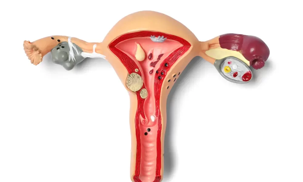 Best IVF Center in Mehsana, Gujarat