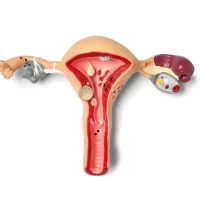 Best IVF Center in Mehsana, Gujarat