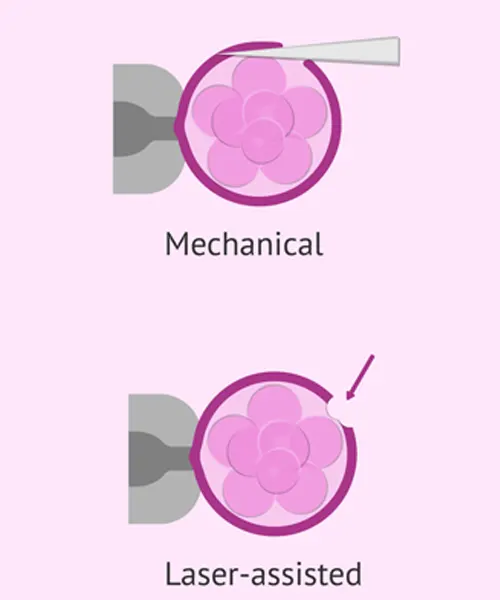 Best IVF Center in Mehsana, Gujarat