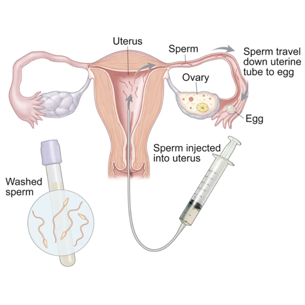 Best IVF Center in Mehsana, Gujarat